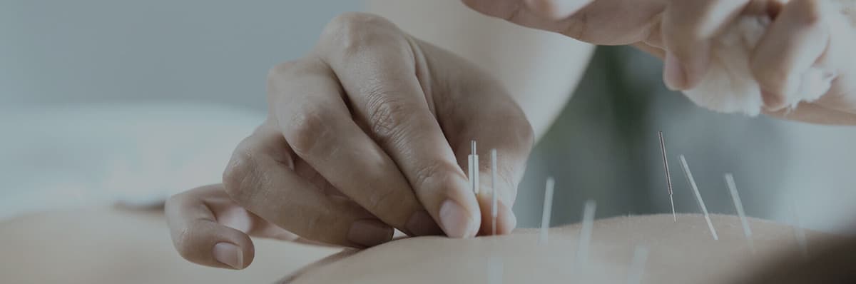 Acupuncture North Vancouver