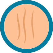 Reduced frown lines