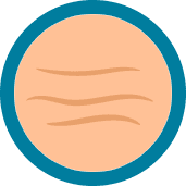 Minimizing the appearance of wrinkles and fine lines